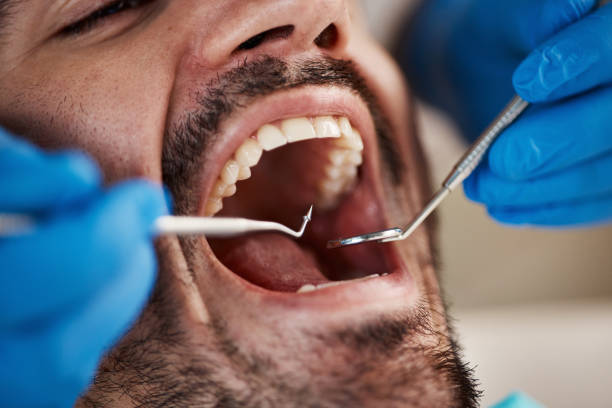 Best Emergency Treatment for Oral Infections in Deer Park, NY